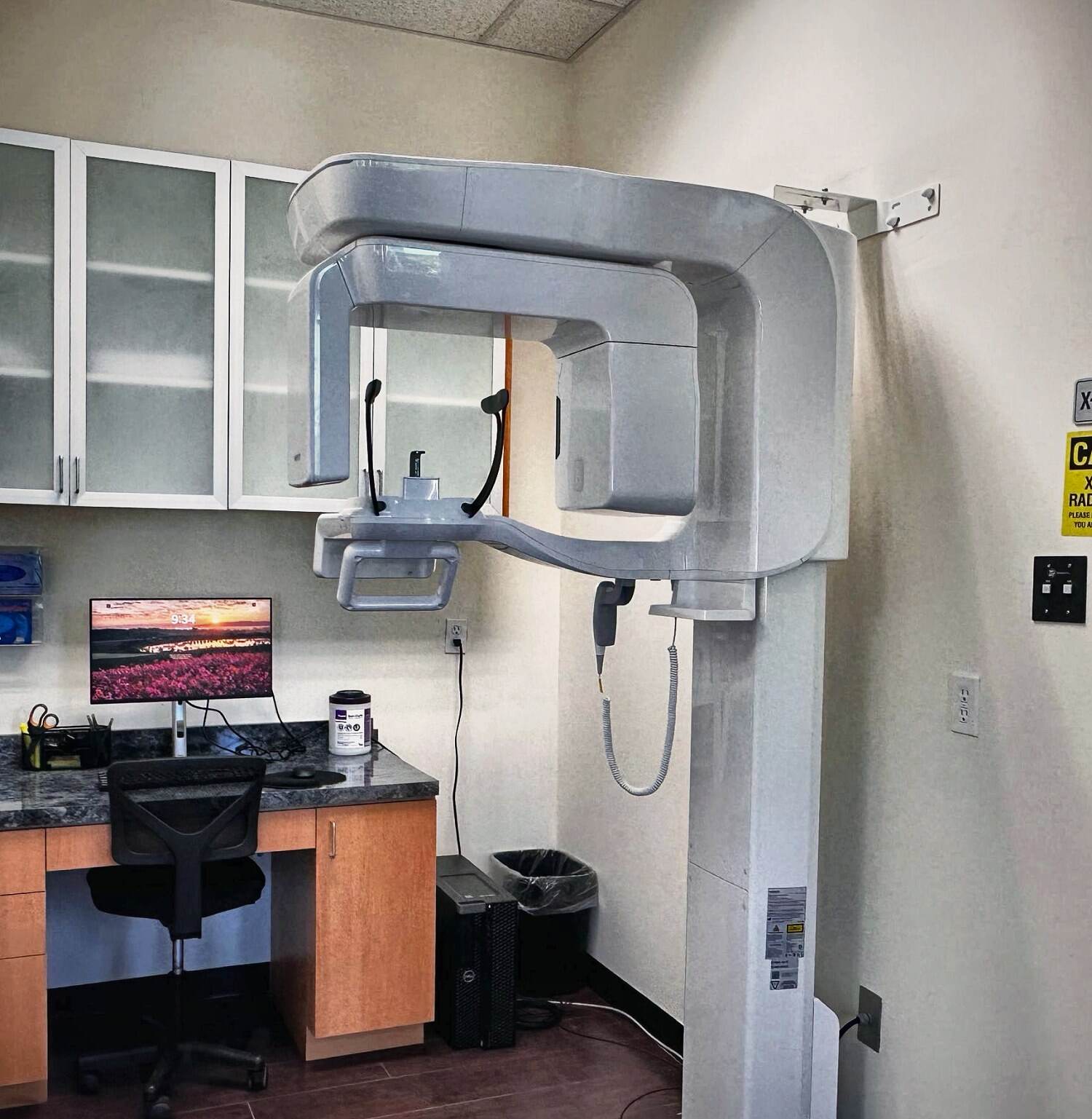 Cracked Teeth treatment at Elite Endo